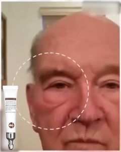 ครีมลดถุงใต้ตา ถุงใต้ตาบวม อายครีม ครีม ลบ ถุงใต้ตา เซรั่มลดตีนกา อายครีมลดใต้ตา