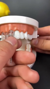 500 BUTIR PENAMBAL GIGI HQ LEM GIGI