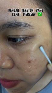 [BPOM] CINDYNAL Skin Cream Remove     Krim Perawatan Kulit Efektif Pigmentasi Menghilangkan Melasma Jerawat Bintik Hitam Fuyan