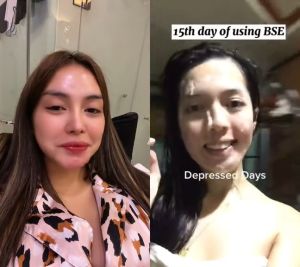 Brilliant Skin Rejuvenating Facial Set Whitening Skin Moisturizer with Hydroquinone Tretinoin Buy Hydroquinone Cream Brilliant Skincare - Lazada