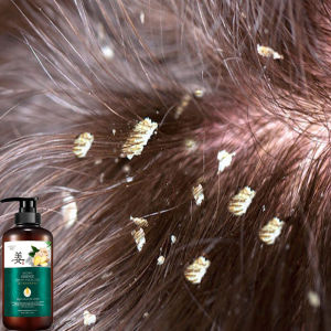 Shampo Jahe: Solusi Rambut Tebal & Sehat