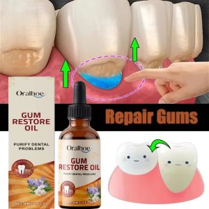 OUHOE | Rapid Soothing Gums Serum Effectively Relieve Tooth Allergy Dental Caries Cleaning Toothpaste Relieve Tooth Damage Drops
