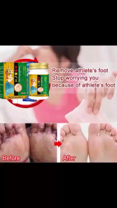[Next Day Delivery ]Thai Athletes Foot Cream 55g Anti-fungal foot deodorant anti-itch eliminate blisters foot treatment athletes foot peeling feet and stinky feet