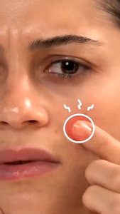 Stiker Jerawat Hydrocolloid Acne Patch Facial Pimple Warna Warni Bintang Star Heart Cute Lucu XX037