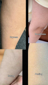 Shawill Buy 1 Take 1 Lotion Whitening Glutathione Lotion Whitening Skin Nicotinamide Lotion 5X Effectiveness Whole Body Whitening Deep Moisturizing Whitening Fragrance Body Loton 500ml+500ml S8014