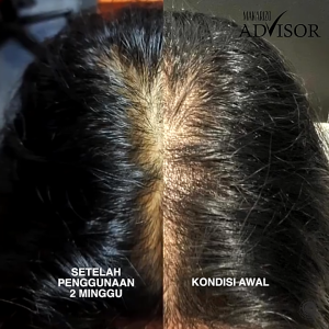 Makarizo Advisor Hair & Scalp Tonic Anti Hair Fall Defense Series 65ml | 145ml | 240ml