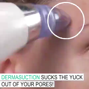 SPEEDS Alat Pembersih Penyedot Komedo Blackhead Remover Pembersih Wajah Elektrik Beauty Kecantikan