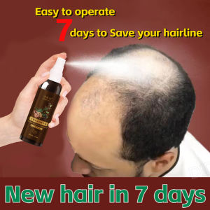 hair growth serum anti hair loss tonic 100ml minoxidil 5 hair growth Hair Growth Supplement Men And Women Anti Hair Loss Prevent Baldness Treatment