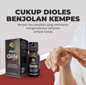OBAT BENJOLAN YANG AMPUH - Oilife Asli Obat Benjolan Obat Embeien Obat Wasir Minyak Oles Benjolan Penghilang Benjolan Di Seluruh Tubuh Obat Benjolan Di Leher Obat Benjolan Di Tangan