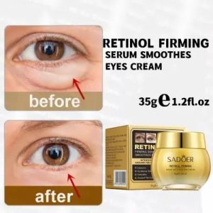 Krim Retinol Anti-Aging SADOER: Solusi untuk Kantung Mata & Flek Gelap