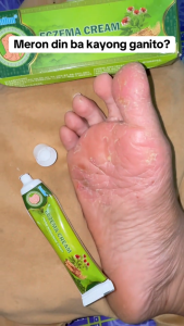 Skin Problems Treatment Eczema Cream Ringworm Dermatitis Ointment Antibacterial Cream Antipruritic Cream Skin Fungal Infection 20g