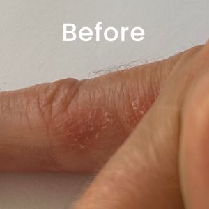 Little Étoile Care Skin Recovery Cream For Dry & Itchy Skin For 0+ Months (170g)