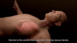 Upgraded Automatic Anti ChokingDevice for Adults Kids Portable First AidHome Airway Rescue Assist