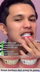 COD/ORI Pasta gigi SP7 odol pemutih gigi dan karang gigi Rrobiotic Whitening Toothpaste -Perawatan Mulut Menyegarkan untuk Gigi Bersih Cocok untuk Priadan Wanita 120g