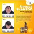 Merry Sun Ginger Shampoo,Conditioner,Or Hair Tonic ANTI HAIR LOSS. 