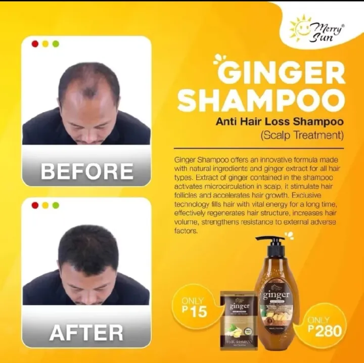 Merry%20Sun%20Ginger%20Shampoo,Conditioner,Or%20Hair%20Tonic%20ANTI%20HAIR%20LOSS%20-%20Image%206