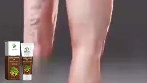 Varicose Veins Ointment Eliminate Spider Legs Vein Relieve Vasculitis Phlebitis Massage Moisturizing Legs Pain Treatment Cream