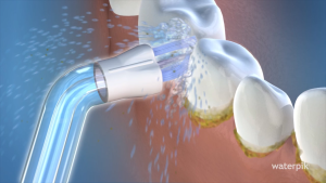 Waterpik PS-100E Plaque Seeker Tip