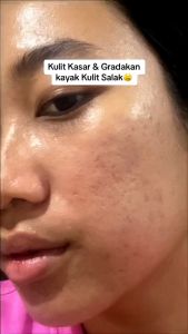 SOMETHINC 10% Lactic + Glycolic Peeling Serum