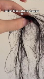 AHE Hair Fall Treatment Shampoo: Solusi Penumbuh Rambut Botak & Mengurangi Kerontokan
