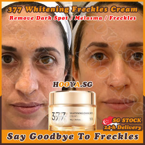 ✅𝙎𝙂 𝙎𝙏𝙊𝘾𝙆✅ 377 Whitening cream / Whitening freckles removal cream / Melasma cream / Dark spot remover cream / 377 美白淡斑面霜