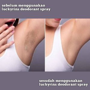 PENGHILANG FLEK HITAM PADA KETIAK SUPER AMPUH