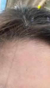 COD/Pinset Pencabut Bulu Halus Wajah Spring Facial Epilator Alat Penghilang Bulu Bibir Hidung Portable