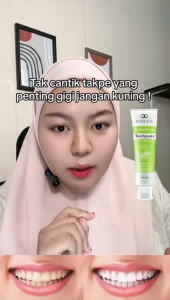 Pasta gigi pemutih gigi Pembersih karang gigi Pemutih gigi kuning Penghilang plak dan noda asap noda kopi dan noda teh Menghilangkan bau mulut Menyegarkan mulut Cegah kerusakan gigi