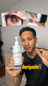 Dermalab Anti Hairloss DHT Blocker+ Biotin Shampoo 300ml