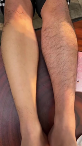 OLLIE ครีมกำจัดขน กำจัดขนรักแร้-แขน-ขา ปลอดภัยไม่เจ็บ 70มล ใช้ได้กับจุดซ่อนเร้น