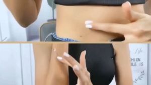 Old Scars Removal & Fire Scar Healing Cream: Peklat Scar Treatment Overview