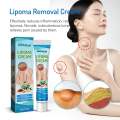 SOUTHMOON LIPOMA REMOVAL CREAM krim pembersih lipoma limfa ketulan keras ketiak leher belakang telinga buang detox badan. 