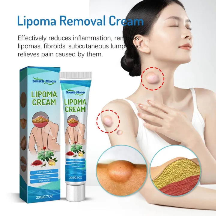 SOUTHMOON%20LIPOMA%20REMOVAL%20CREAM%20krim%20pembersih%20lipoma%20limfa%20ketulan%20keras%20ketiak%20leher%20belakang%20telinga%20buang%20detox%20badan%20-%20Image%205
