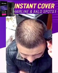 Hair Fiber Penebal Rambut: Manfaat & Cara Penggunaan