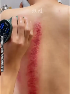 Home Electric Massager Reduce Back Shoulder Neck Pain/Relieve Scraping Machine Detox Massager Scrapping