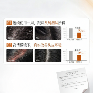 FIVE CEREALS | Anti-Oil Dandruff-Relief Anti-Itch Shampoo for Men and Women Amino Acid Formula