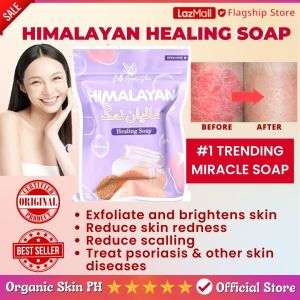 Bella Amore Skin Himalayan Healing Soap - Natural Eczema and Psoriasis Cream and Lotion for Allergy Treatment with Salt