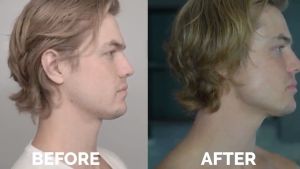 Dụng Cụ Nhai Tập Cơ Hàm Giúp Làm Giảm Mỡ Và Làm Thon Gọn Khuôn Mặt Cho Nam