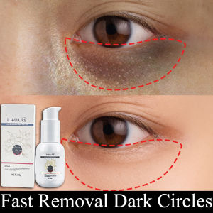 Eyebags Remover Original Eye Care Cream for Dark Circle and Eyebags Remover for Men Eye Cream for Eyebags Puffy Eyebag and Dark Circle Remover Wrinkles Eye bag Remover Cream Whitening Eyecream Massager Anti Aging Eye Drops