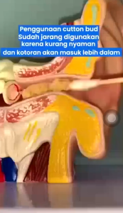 Alat Pembersih Telinga Stainless Set 5in1 Alat Korek Kuping Earpick 5 In 1