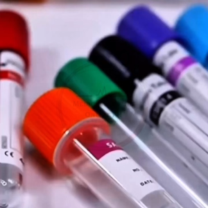 Blood Collection Vacuum Tubes KINGMED/Surgitech Vacutainer sold as per PIECE (Plain Edta Sodium Heparin)