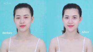 Mặt nạ thuỷ tinh trắng da cấp ẩm Dr. Lacir Glutathione 1 hộp