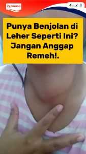 Zymuno Untuk Benjolan - Madu Herbal Atasi Benjolan Tumor Kanker Zymuno Original Asli