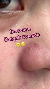 Masker Wajah Brightening Wanita Pria AZRINA Pure Charcoal Mud Mask - masker komedo/masker kecilkan pori pori/masker pencerah