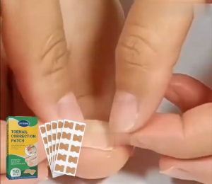 JAYSUING Toenail Correction Patch 50pcs – Foot Care Sticker for Nail Straightening Pain Relief & Correction Ingrown Toenail Relief Tape