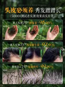 CKCU | Dầu Gội Thảo Dược Chống Rụng Tóc và Kiểm Soát Vảy Nến Thiên Nhiên Shampoo Bar