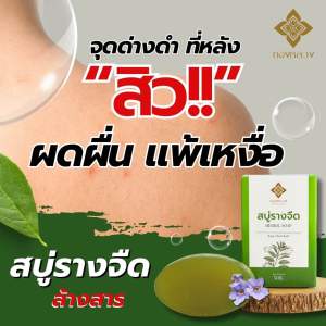 📍สิวหลัง เเพ้เงื่อ ผดผื่นคัน ฟอกสบู่รางจืด ตราทองหลวง🌟