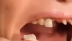 Snap On Smile Venners Gigi Perfect Smile Gigi Tiruan Gigi Palsu 1 Set Atas Bawah