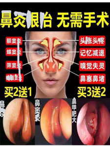 Childrens Nasal Spray Chronic Allergic Clearing Nasal Passages Quick Relief Oil of Dandelion Seeds for Blocked Noses