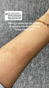 BIO HERBAL MEILI BEAUTY CREAM PENGHILANG BEKAS LUKA